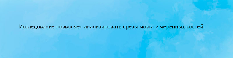 Мрт головного мозга и сосудов головного мозга в кургане